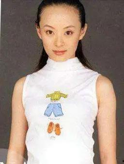 娱乐圈哪些明星植发了,从脱发危机到华丽蜕变